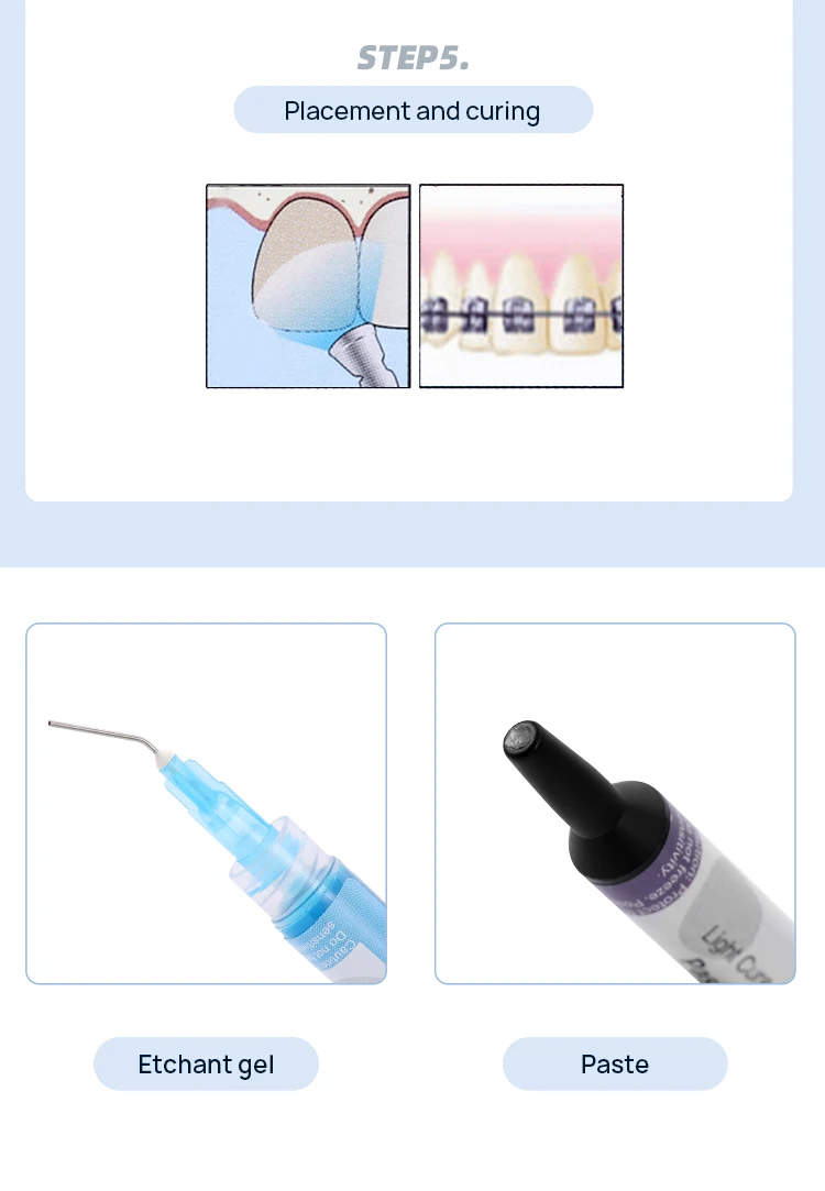 AZDENT Dental Orthodontic Light Cure Adhesive Bonding Brackets Braces Ortho-Bonding Primer Paste Kit Zahnheilkunde – Detail 6