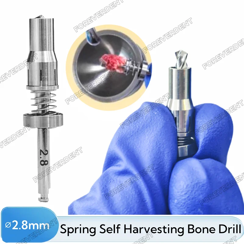 

Dental Spring Grinding Bone Harvest Drill Trephine Drills Implant GBR Collection 2.8MM