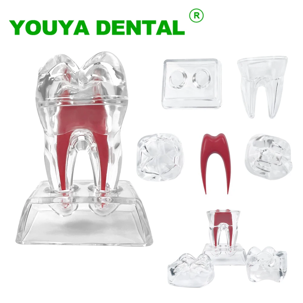 Dental Anatomical Model Transparent Molar Model Detachable Single Tooth Structure Decomposition Demonstration Model Crystal Base