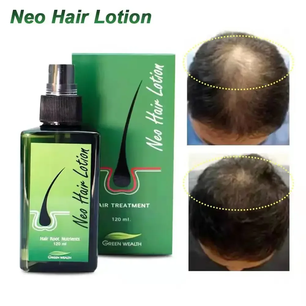 120ml Thailand Hair Growth Essential Oil Spray for Men Woman Hair Growth Anti Hair Loss Perfume Neo Hair Lotion