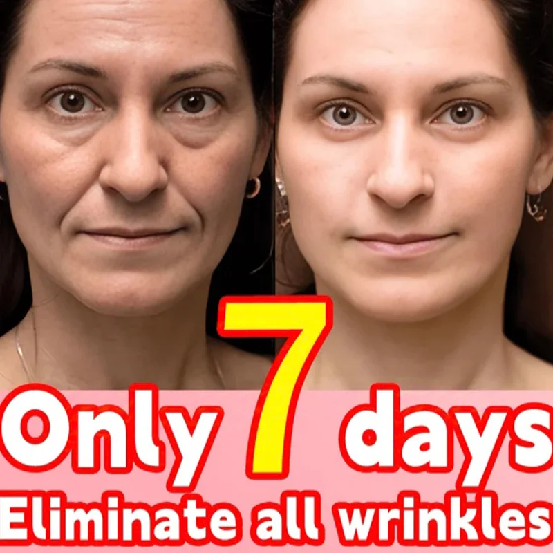 

Korean Original Eye Bags Removal Serum - Dark Circles Treatment, Anti Puffiness, Wrinkle Care, Hyaluronic Acid Snail Mucin, Anua