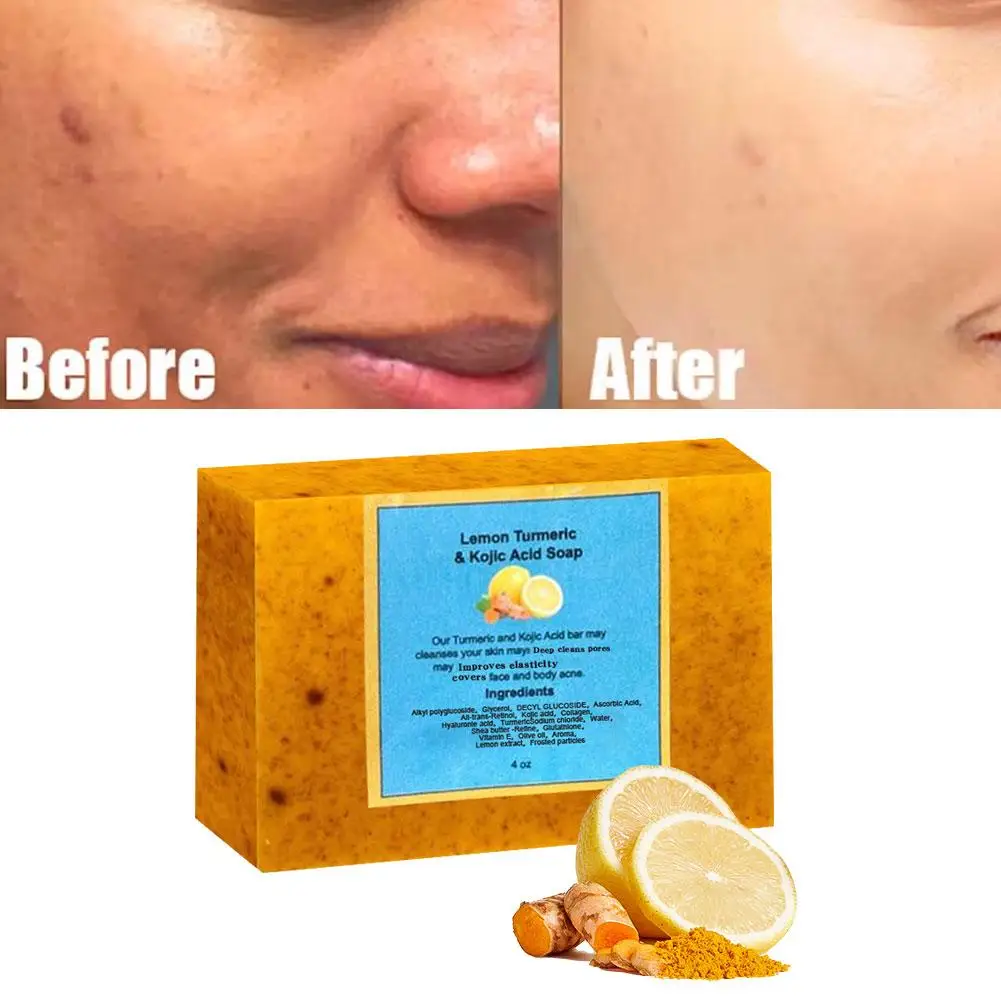 Turmeric Lemon Soap Bar For Face Body Tumeric Soap Smooth Skin Cleansing Natural Handmade Soap Skin Formula Soap For Women Y5P1