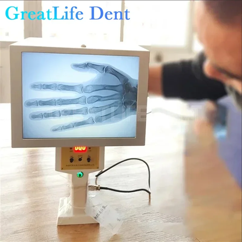 GreatLife Dent Medical Portable X-ray Machine Orthopedic Fluoroscopy Detection Veterinary Pets Dog X Ray Camera Sensor Scanner