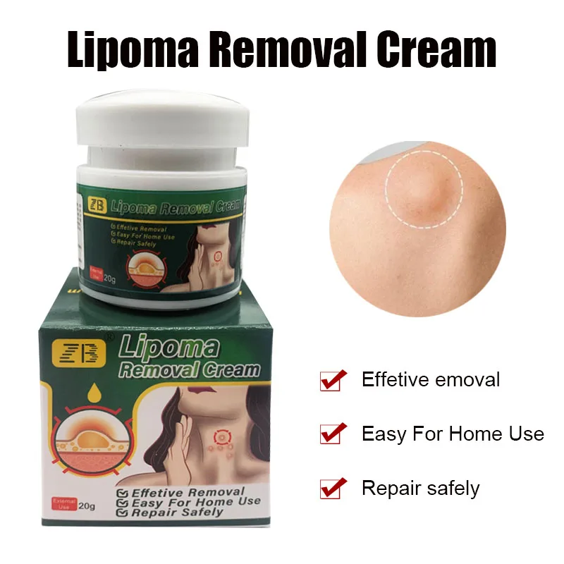 Chinese Herbal Lipoma Pain Relief Ointment Multiple Anti-Tumor Peeling Fat Mass Remove Cream Medicine Swelling Removal Plaster