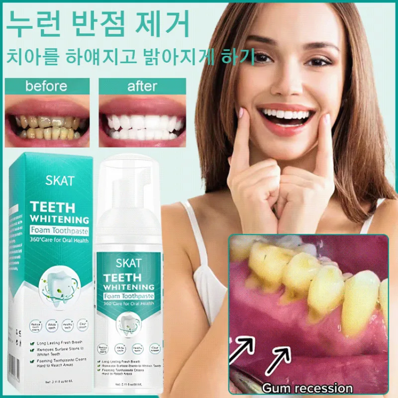 1/1 + 1 Tissue whitening toothpaste for toothpaste cleaning mooth whitening toothpaste 50ml tooth strengthening toothpaste for white toothpaste for Nu spots tooth clean mouth gimmier mite removal foam toothpaste