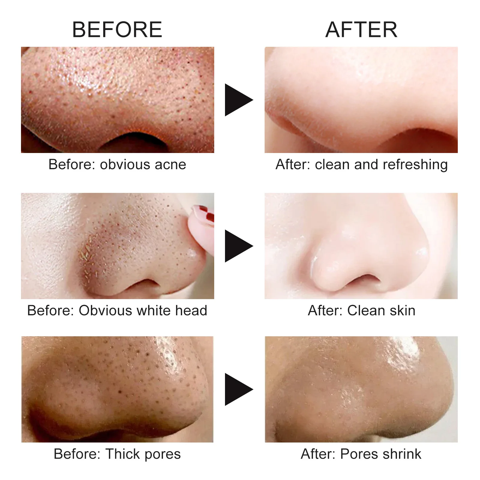 Nose Blackhead Remover Mask Deep Cleansing Pore Cleaner Sticker Acne Treatment Mask Skin Care Nose Black Dots Clean Strips