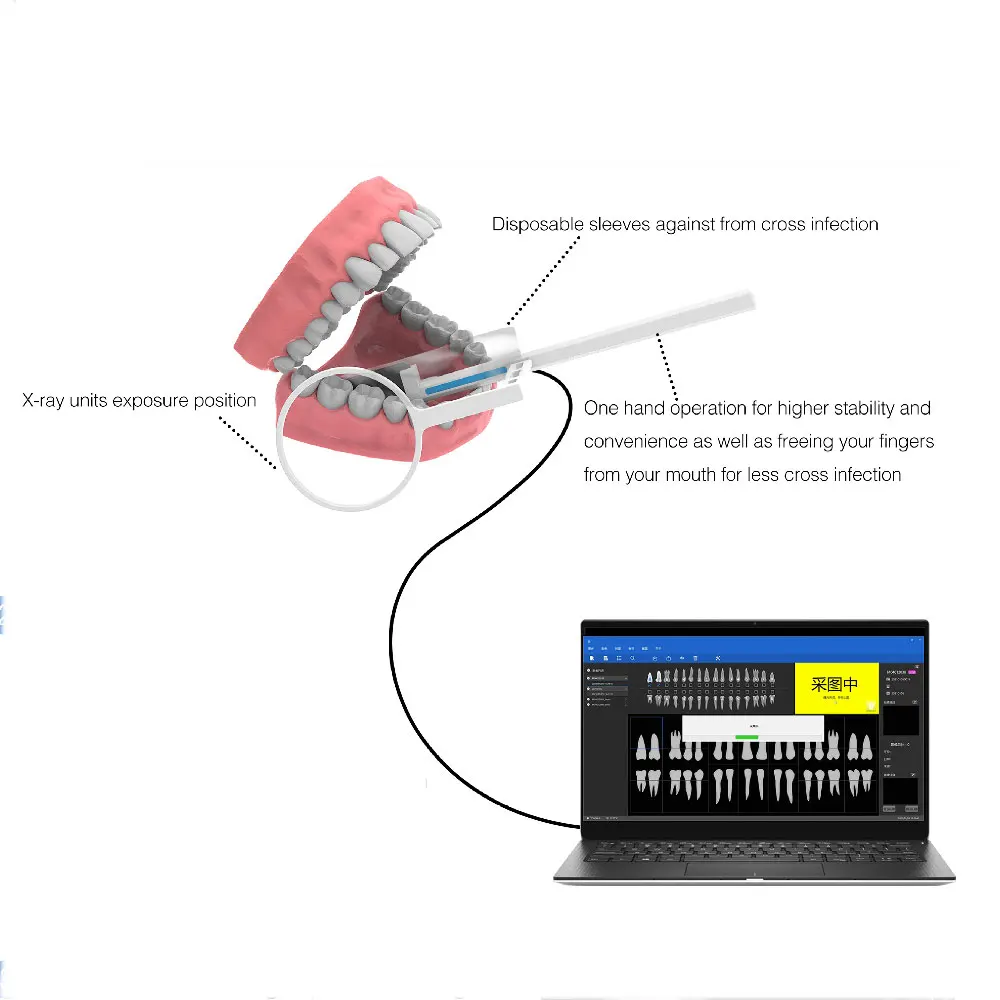 D042N High Resolution R1 R2 Wireless Intraoral Imaging Digital Dental X-ray Sensor With Free Software
