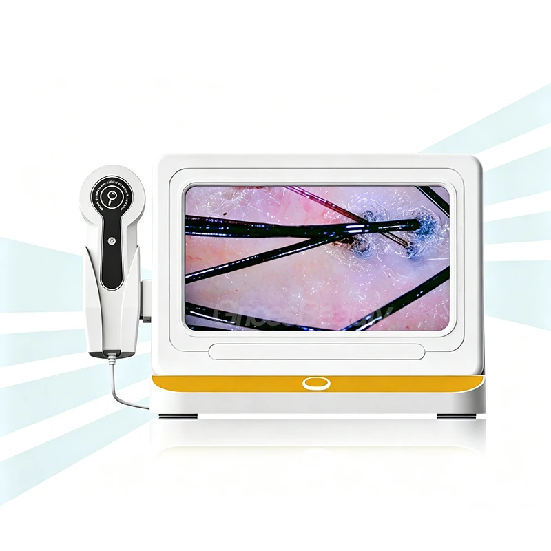 10 Inch Display Scalp Skin Analyzer Dual 50X 200X HD Camera Lens Portable Integrated Hair Follicle Hair Loss Diagnostic Machine