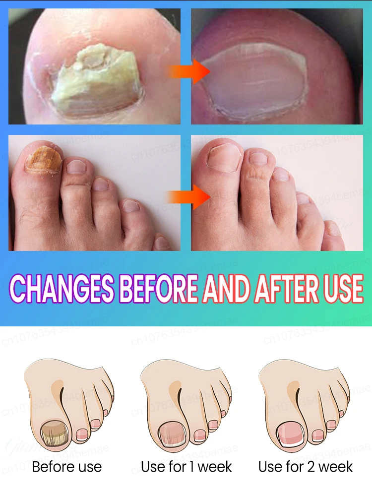 New nail care products