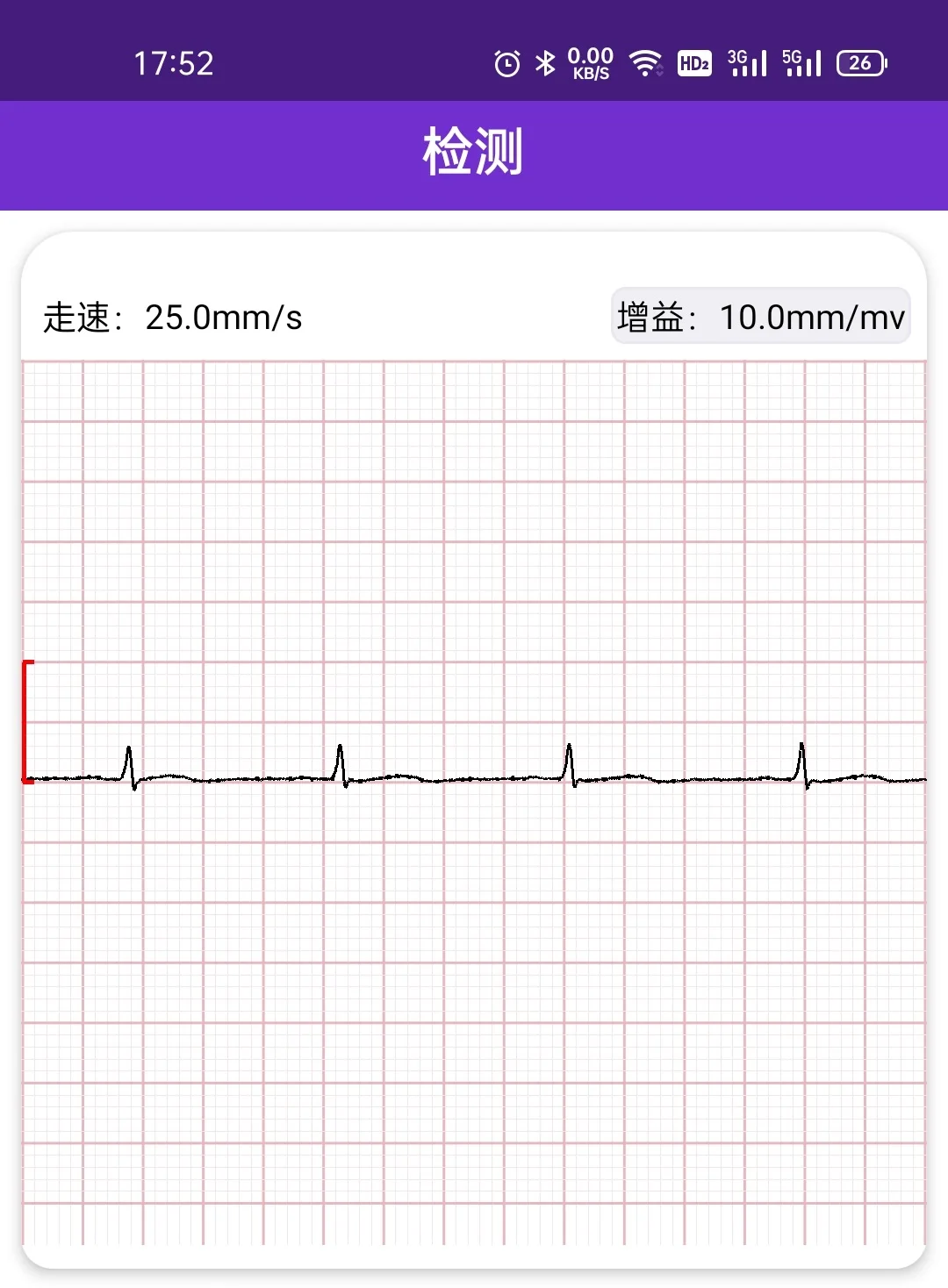 Desarrollo de software y hardware para módulo de adquisición PCB, electromigrafía de computadora cardíaca, frecuencia cardíaca de pulso de oxígeno en sangre