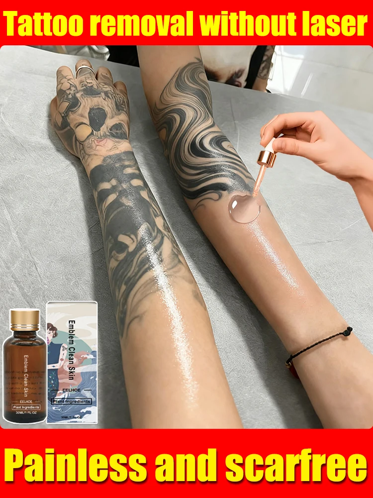 

7 days to fade stubborn tattoos and repair skin without scars