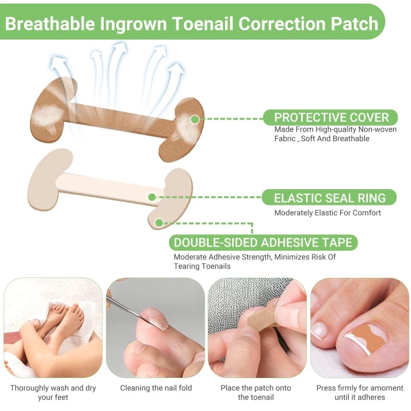 20-100pcs Ingrown Toenail Correction Strips Lasting Adhesion Waterproof Nail Correction Stickers Elasticity Toe Care Pedicure