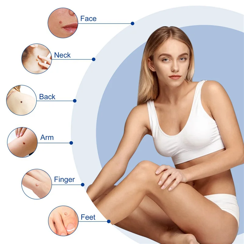 

2X набор для удаления меток на коже, ручка для удаления меток на коже, легкое устройство для удаления меток на коже, удаляет бирки на коже 4–9 мм