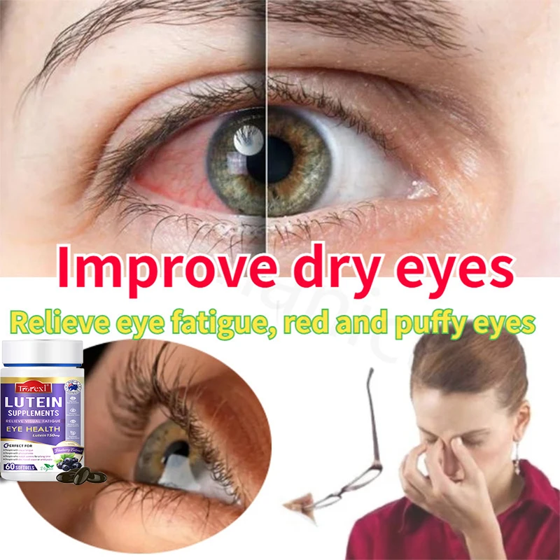 Trorexl Restore Vision Lutein Extract Supplement for Eye Strain Relieve Eye Fatigue Red & Dry Eye