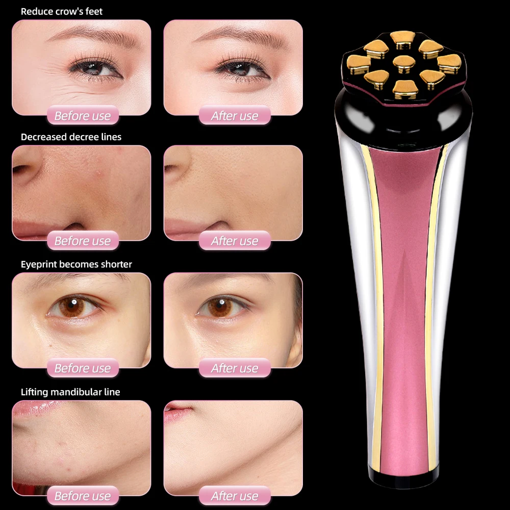 Rf ems led radiofrequência micro-elétrico anti-envelhecimento face lift cuidados com a pele uso doméstico equipamento de beleza massageador facial