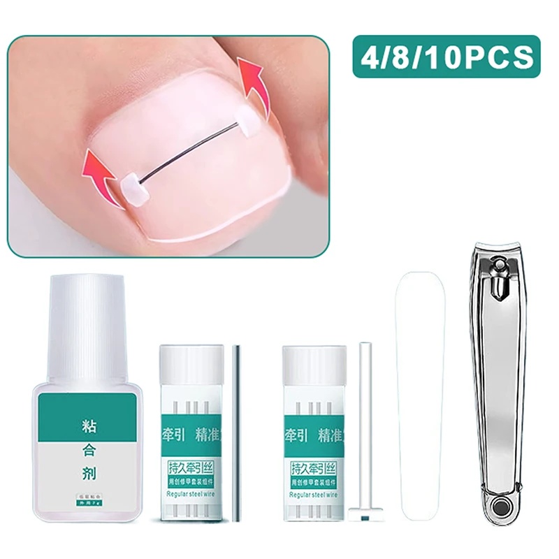 Ingrown Toenail Corrector Tools Pedicure Recover Embed Toe Nail Treatment Professional Ingrown Toenail Straightening Clip Brace