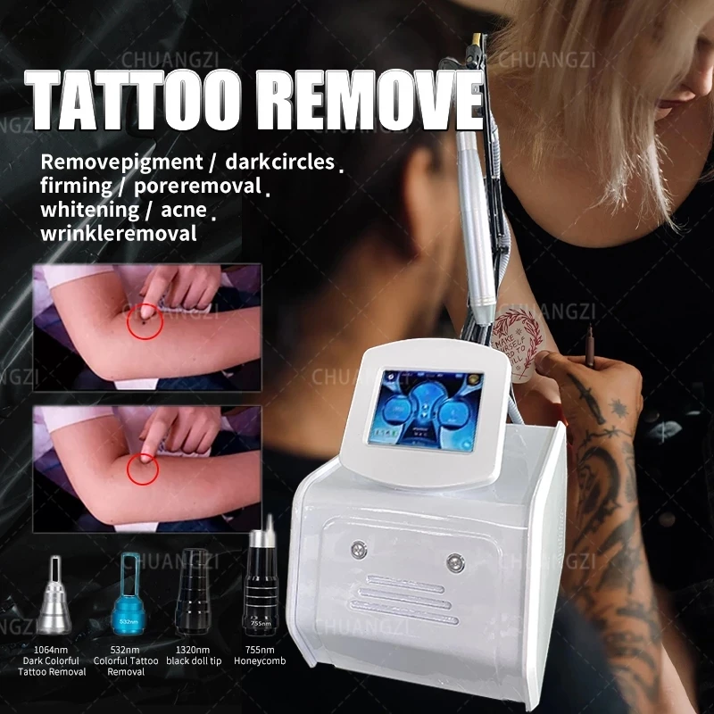 Portable q switch nd yag tattoo removal machine 1064nm 532nm 1320nm skin whitening pigment Wrinkle removal CE