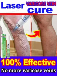 Varicose vein laser product