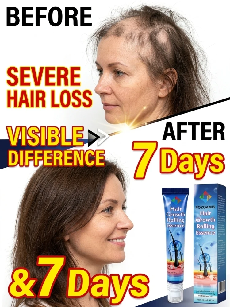 Scalp Massaging Roll-on Essence Serum, Easy Glide Roller Design, Nourishing Formula for Dry Scalp, Keep Scalp Comfortable, Smooth Hair, Portable Home Scalp Care Liquid