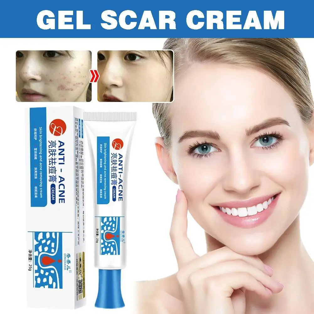 Effectieve Acne Behandeling Crème Anti Mee-Eters Acne Krimpen Huid Schoonheid Poriën Verzorgingsplekken Fleuren Producten Hydraterende Smoo V2g9