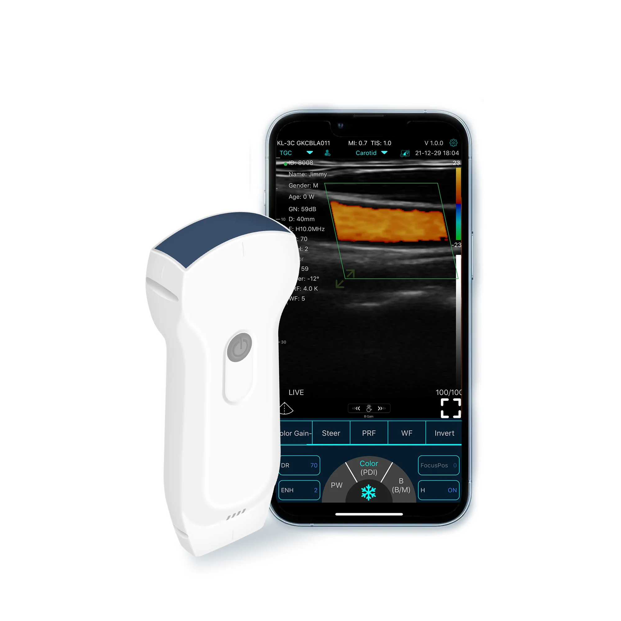 Konted C10RL 3-in-1 Probe Wireless Ultrasound Scanner Handheld for iOS Android Windows CE MDR Certified
