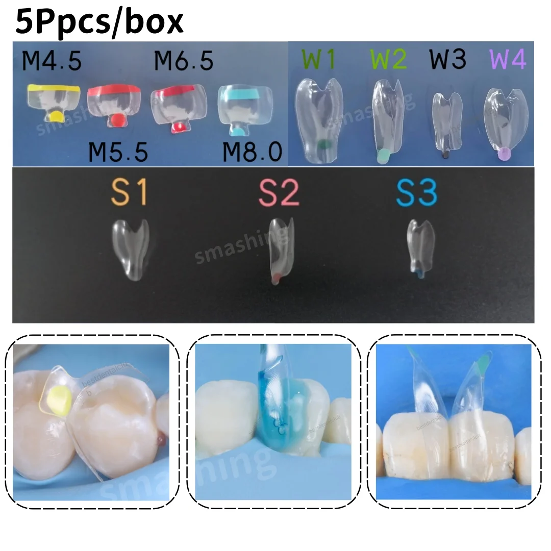 5Pcs Dental Transparent Clear Matrix Anterior Posterior Restoration BT Bow Matrices Contoured Fit BioClear