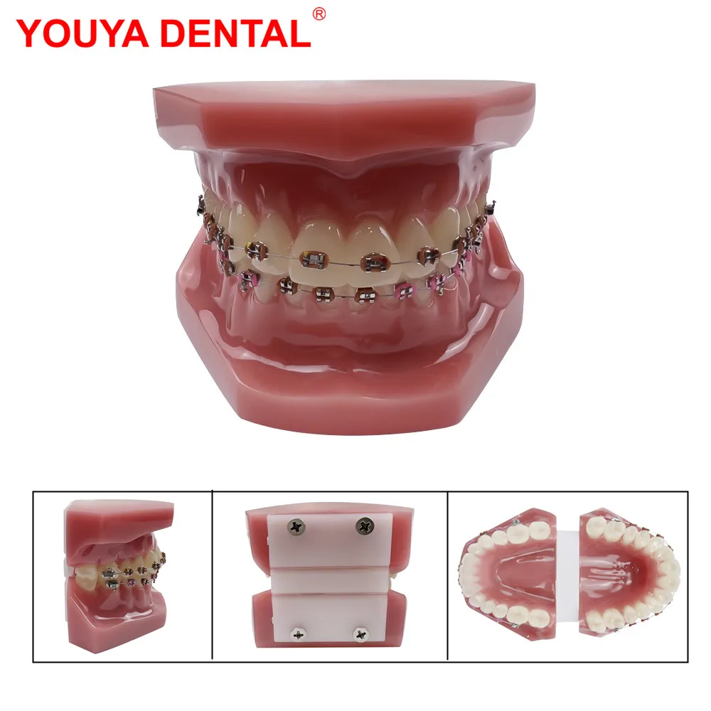 Dental Teeth Model For Studying Normal Dental Orthodontic Teeth Model With Fully Metal Brackets Standard Adults Teaching Models