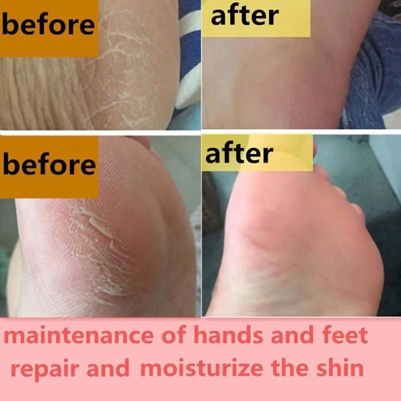 New Nourishing Beauty Health Foot Hydrating Cream Remove Dead Skin Creams Hand Feet Care Skin Hand And Foot Cream Anti-dryness