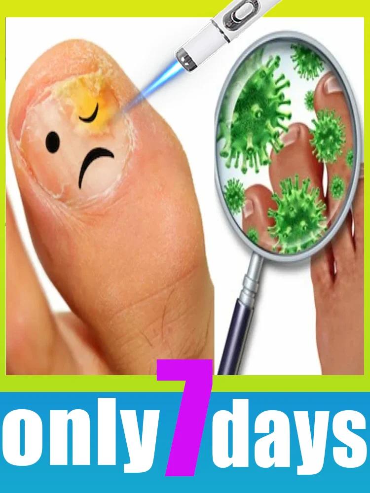 

Технологии второго поколения 2025 года. Изменение жизни. Скажем добро пожаловать проблемы с ногтями.