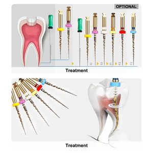 6 pcs/box Flexible Dental Gold Files Endo Rotary Files Gold Endodontic Files 21/25/31mm Nickel Titainium Dental Instrument 10 Main Sales Rotary Lima - №1