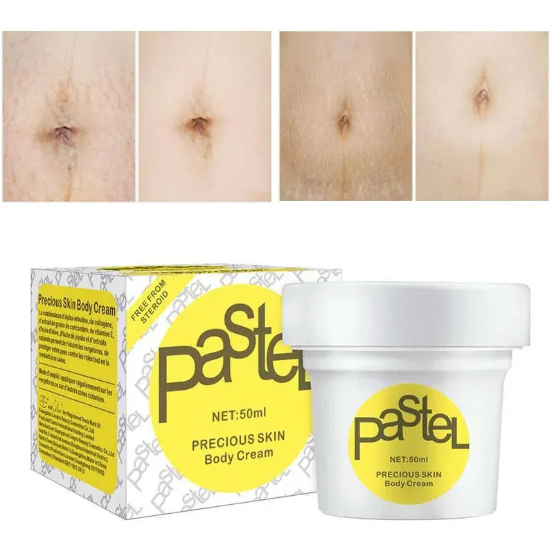 1pc Stretch Marks Remove Cream Restore Skin Elasticity Nourish The Skin Deeply Non-Greasy Texture Absorbs Quickly Body Skin Care