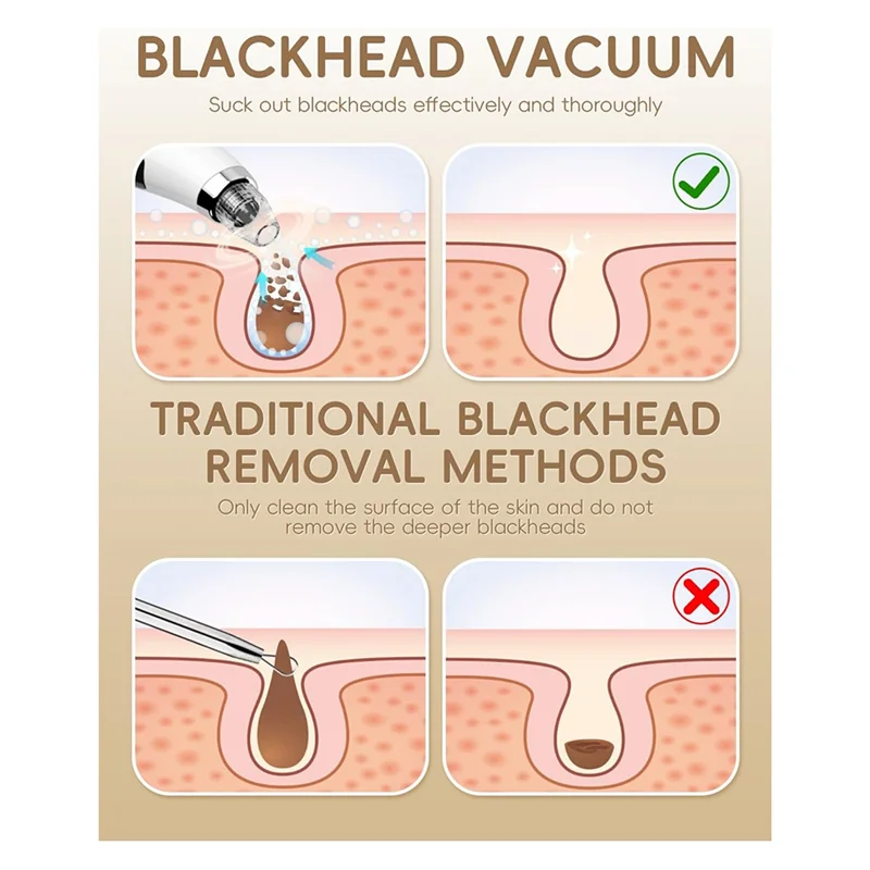 ABVI-Blackhead Remover เครื่องมือ Blackhead Remover เครื่องมือสกัดสูญญากาศ Forestheticians