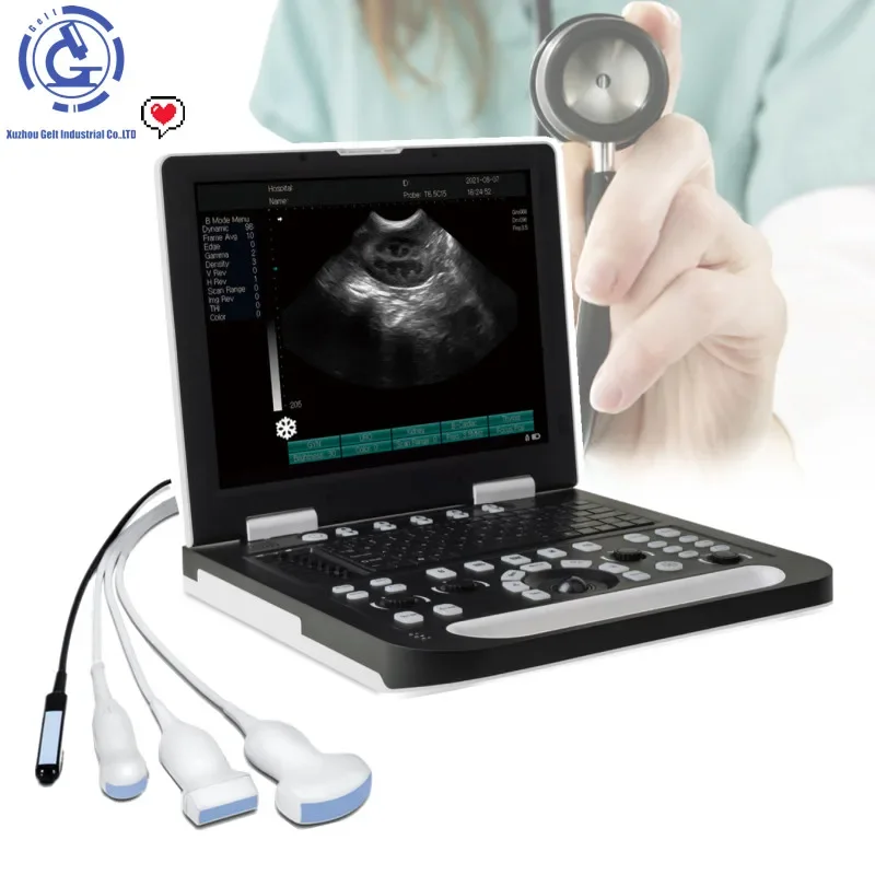 Good Quality Mindray DP-30 BW Portable Full digital ultrasound machine /Mindray ultrasound machine