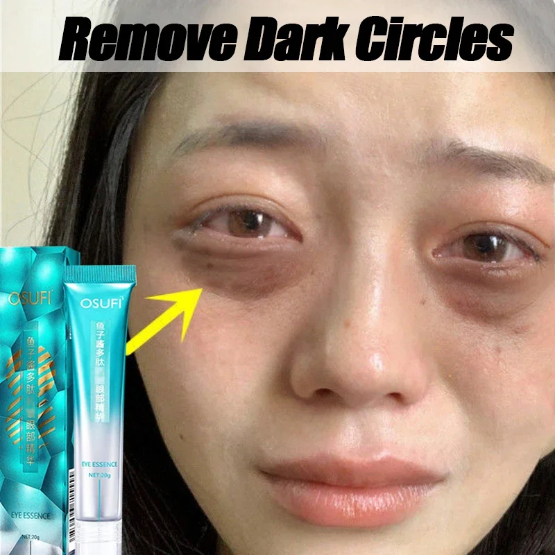 

Anti-Wrinkle Dark Circles Eye cream Remove eye bags Puffiness way work under eyes Lightening Moisturizing Whitening Skin Care