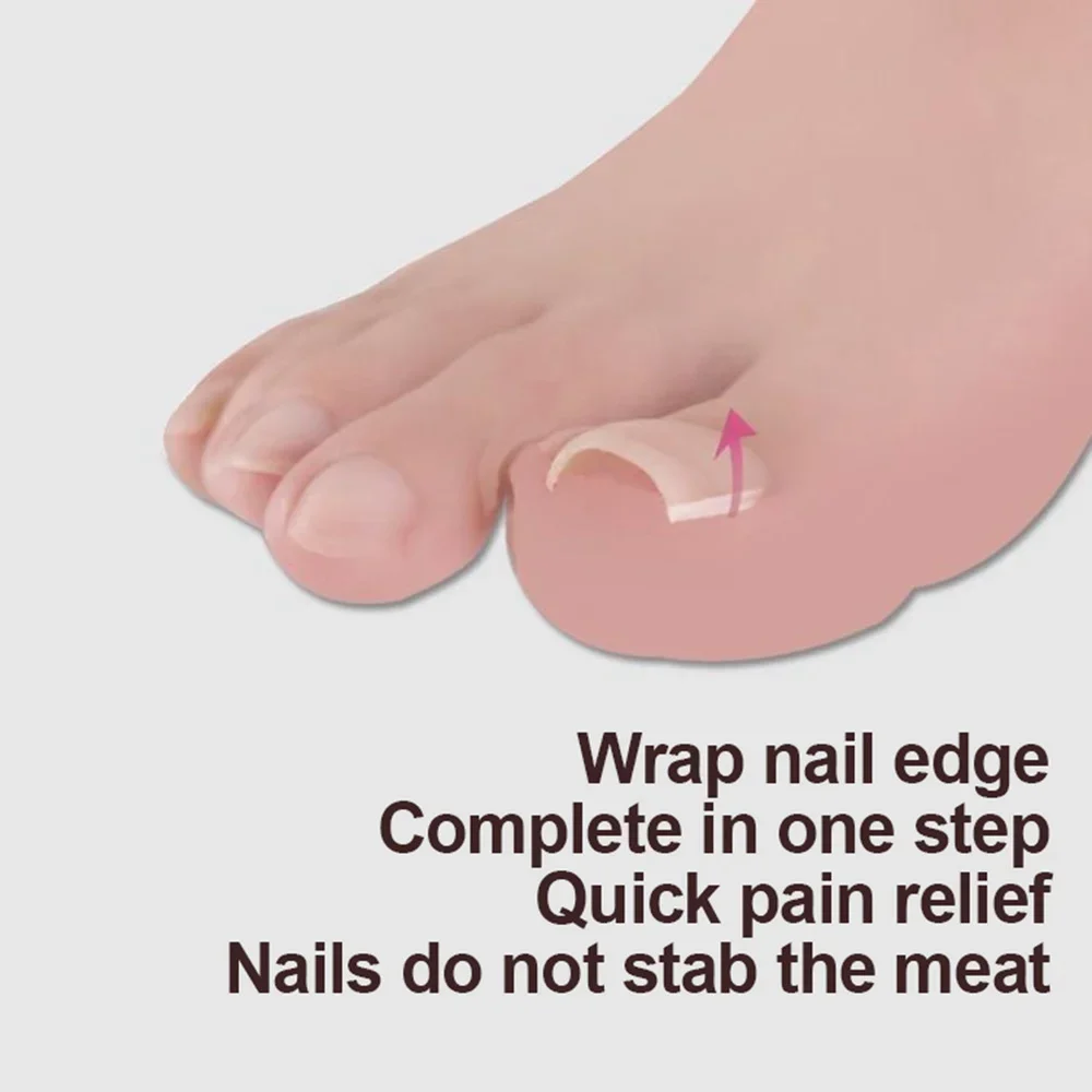 10pcs Ingrown Toenail Correction Tool Ingrown Toe Nail Treatment Elastic Patch Sticker Straightening Clip Brace Pedicure Tool