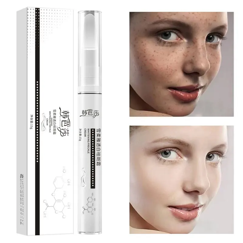 Freckle Cream Whitening Moisturizing Remove Dark Spots Brighten Tone Even Skin Tone Improve Facial Pigmentation Face Skin Care