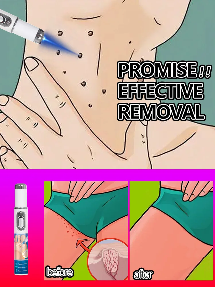 

Get better before the end of summer