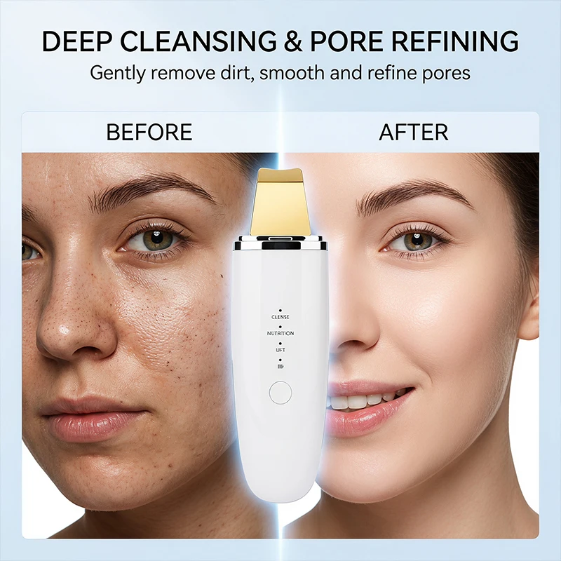 limpiador-facial-ultrasonico-lesen-para-el-cuidado-de-la-piel-exfoliante-de-puntos-negros-y-blancos-raspador-facial-vibratorio-limpiador-profundo-de-poros-lifting-facial
