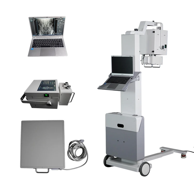 Mobile digital radiography system, portable mobile DR X-ray machine with flat panel detector for hospital bedside radiography