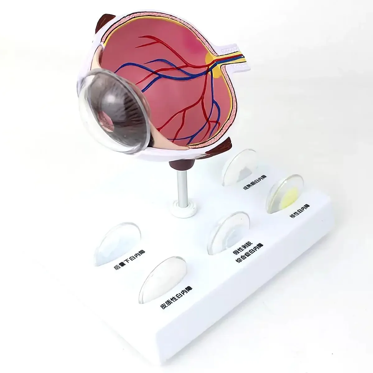 Human Cataract Magnification Eye Internal Anatomy Model Medical Teaching Models