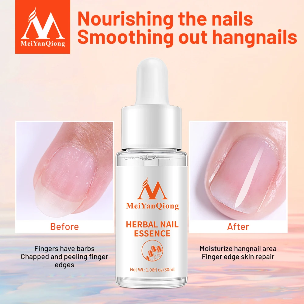 Nail Care Essence Serum Care Hand Foot Care Nail Fungus Treatment Essence Nails Restore Nail Shine Nail Repair Oil Health Beauty