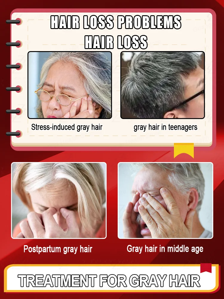 مصل الشعر المضاد للرمادي | شعر رمادي عكسي في أسابيعين! اشتر 3 واحصل على 2 مجانًا، الأكثر مبيعًا الآن #2