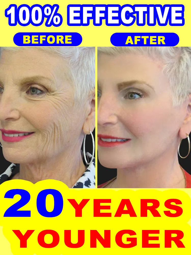 

20 years younger, no fine lines