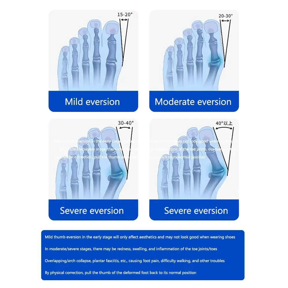 New Adjustable Toe Corrector Rotatable Pedicure Foot Care Bunion Corrector Hallux Valgus Orthopedic Supplies Big Toe