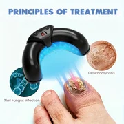

1/2/4 Pcs Nail Fungus Light Device for Multiple Fingernails & Toenails