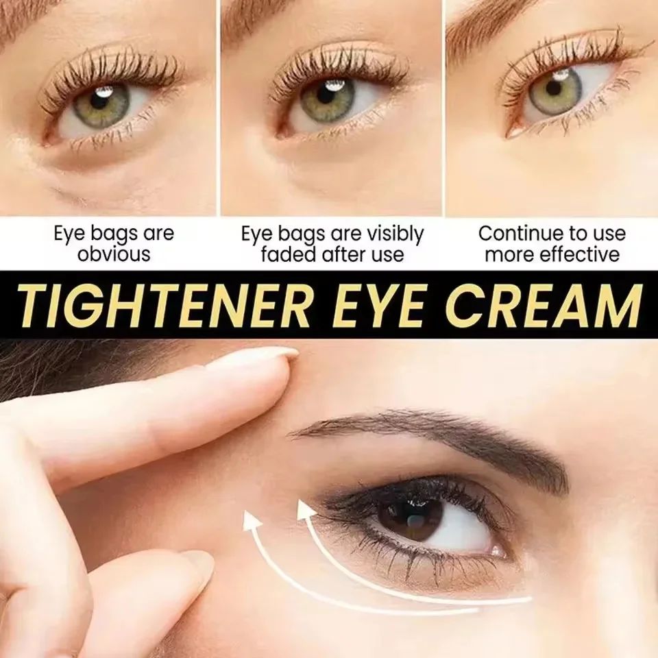 Creme instantâneo para remoção de bolsa de olhos, retinol, anti-rugas, firmador da pele, linhas finas, anti-círculo escuro, inchaço, iluminar, cuidados com os olhos