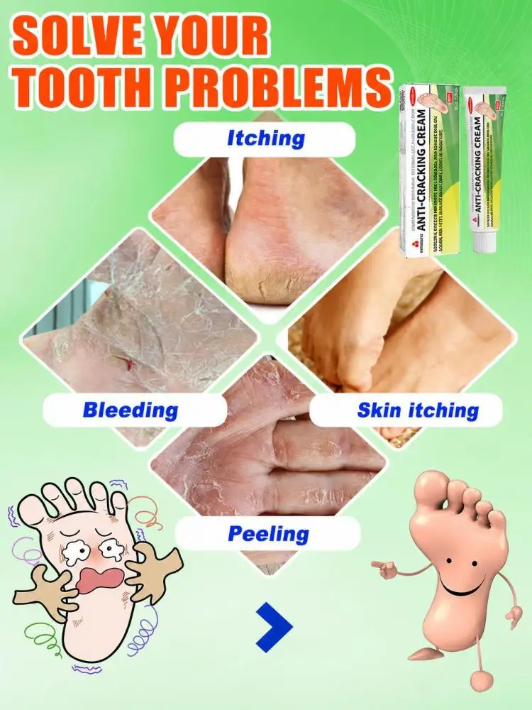 Hand Foot Moisturizing Repair Cream, Gentle Skin Care Balm for Dry Rough Skin, Soften Cuticle, Lock Skin Moisture, Relieve Dry Tightness for Elbow Heel Daily Skin Care