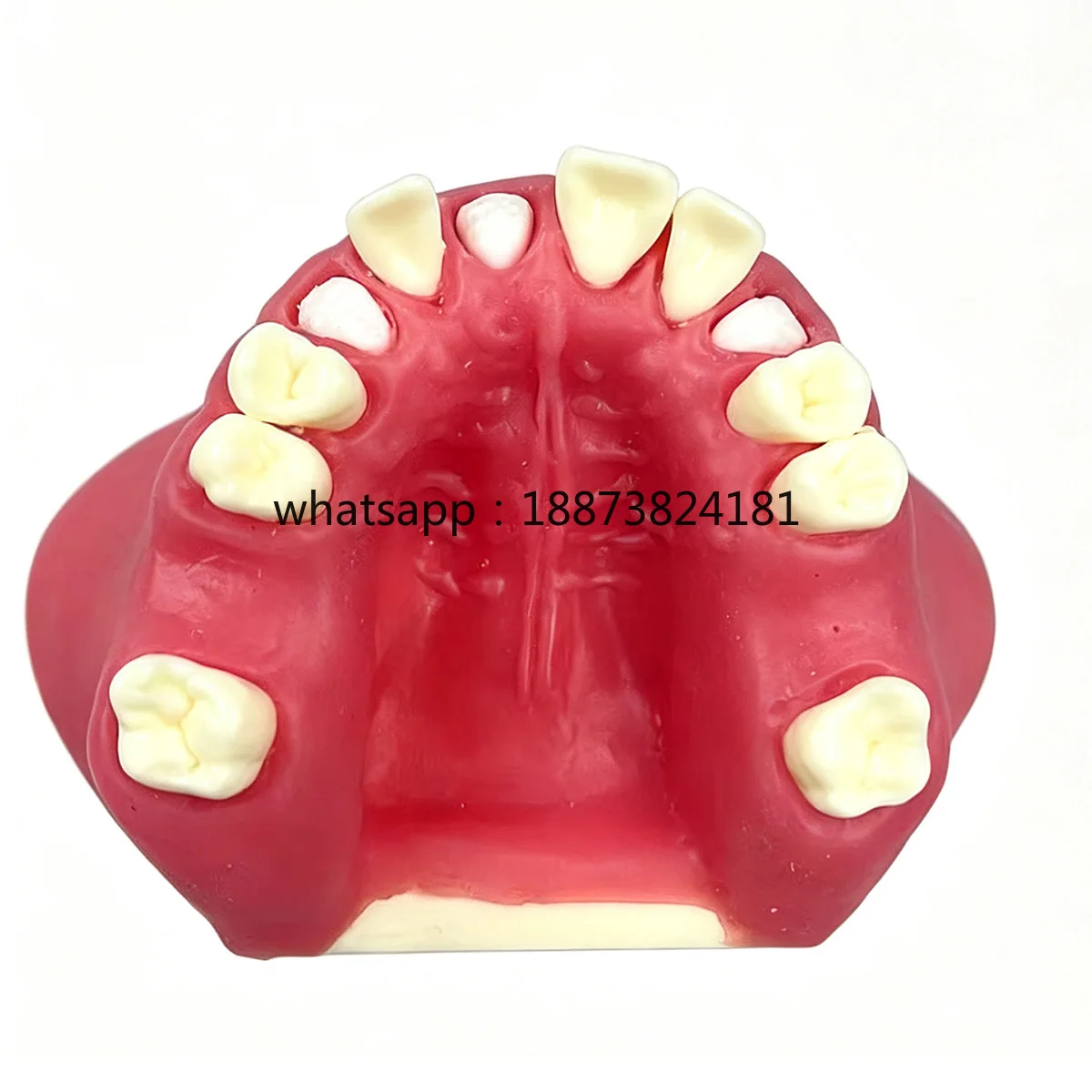 Dental Socket Shield Training Model, Maxillary Sinus Lift Implant Practice Model with Removable fast shipping