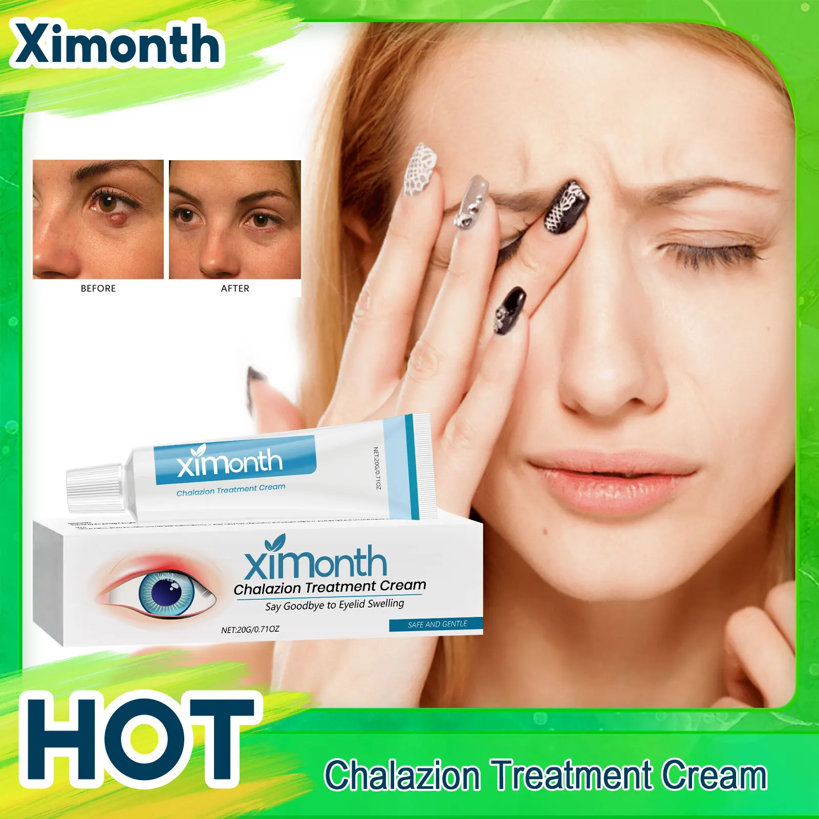 

Stye Eye Chalazion Treatment Cream Blepharitis Removal Eyelid Swelling Redness Fade Eye Bags Dark Circles Fine Line Moisturizing