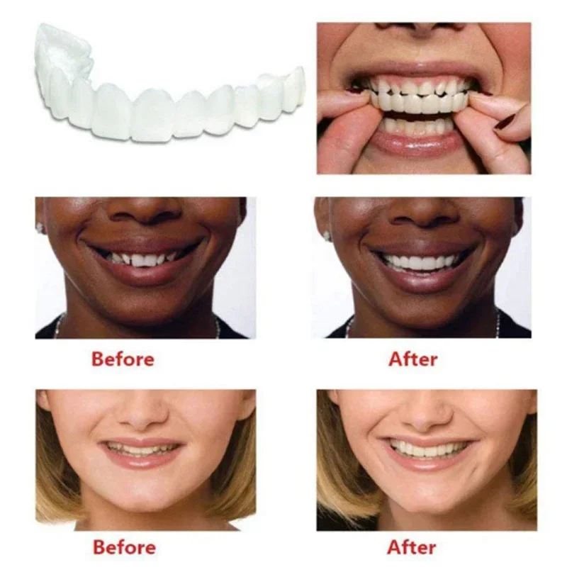 Perfect Fit Teeth Whitening copertura per denti finti Snap On Silicone Smile impiallacciature strumento per la parte superiore dei denti copertura per denti finti igiene orale